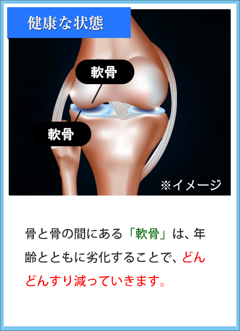 骨と骨の間にある「軟骨」は、 年齢とともに劣化することで、 どんどんすり減っていきます。