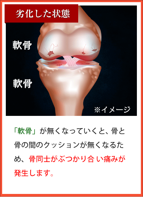「軟骨」が無くなっていくと、 骨と骨と間のクッションが無く なるため、骨同士がぶつかり合 い痛みが発生します。