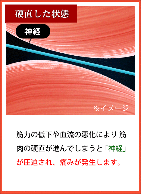筋力の低下や血流の悪化により 筋肉の硬直が進んでしまうと 「神経」が圧迫され、痛みが発生します。